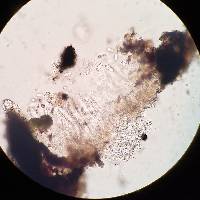 Anisomeridium polypori image