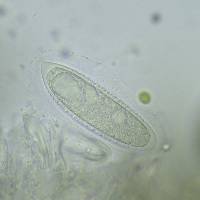 Pertusaria xanthodes image