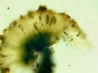 Dactylospora athallina image