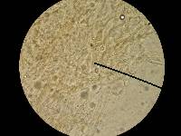 Lichenomphalia umbellifera image