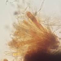 Bactrospora brodoi image