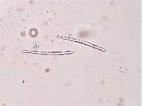 Bacidia suffusa image