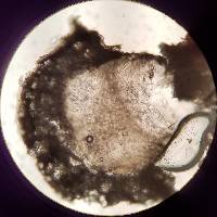 Pertusaria paratuberculifera image