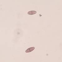 Baculifera curtisii image