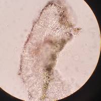 Huneckia pollinii image
