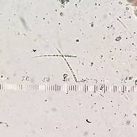 Bacidia suffusa image