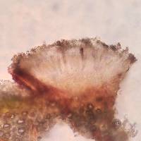 Arthonia rubrocincta image
