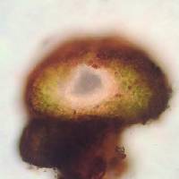 Pyrenopsis phaeococca image