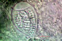 Arthothelium orbilliferum image