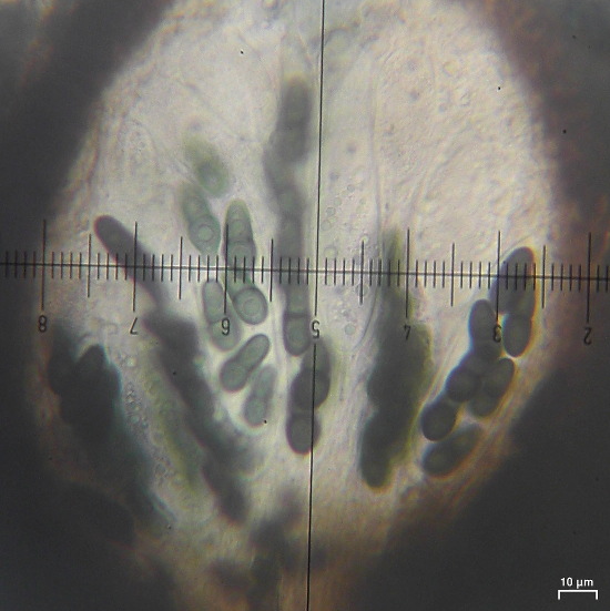 Polycoccum sporastatiae image