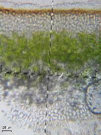 Catapyrenium rufescens image
