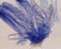 Pertusaria chiodectonoides image